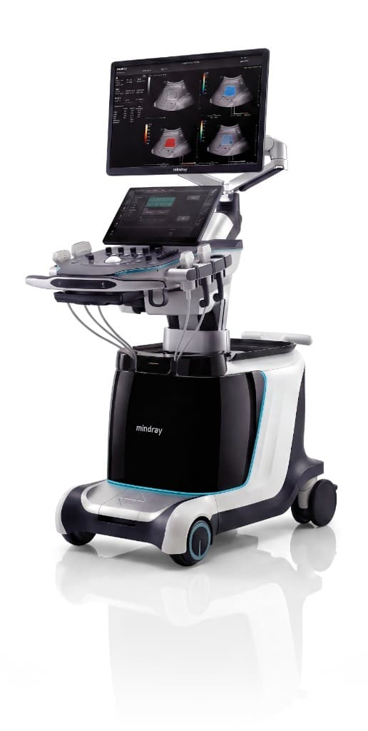 UZI diagnostikasi
